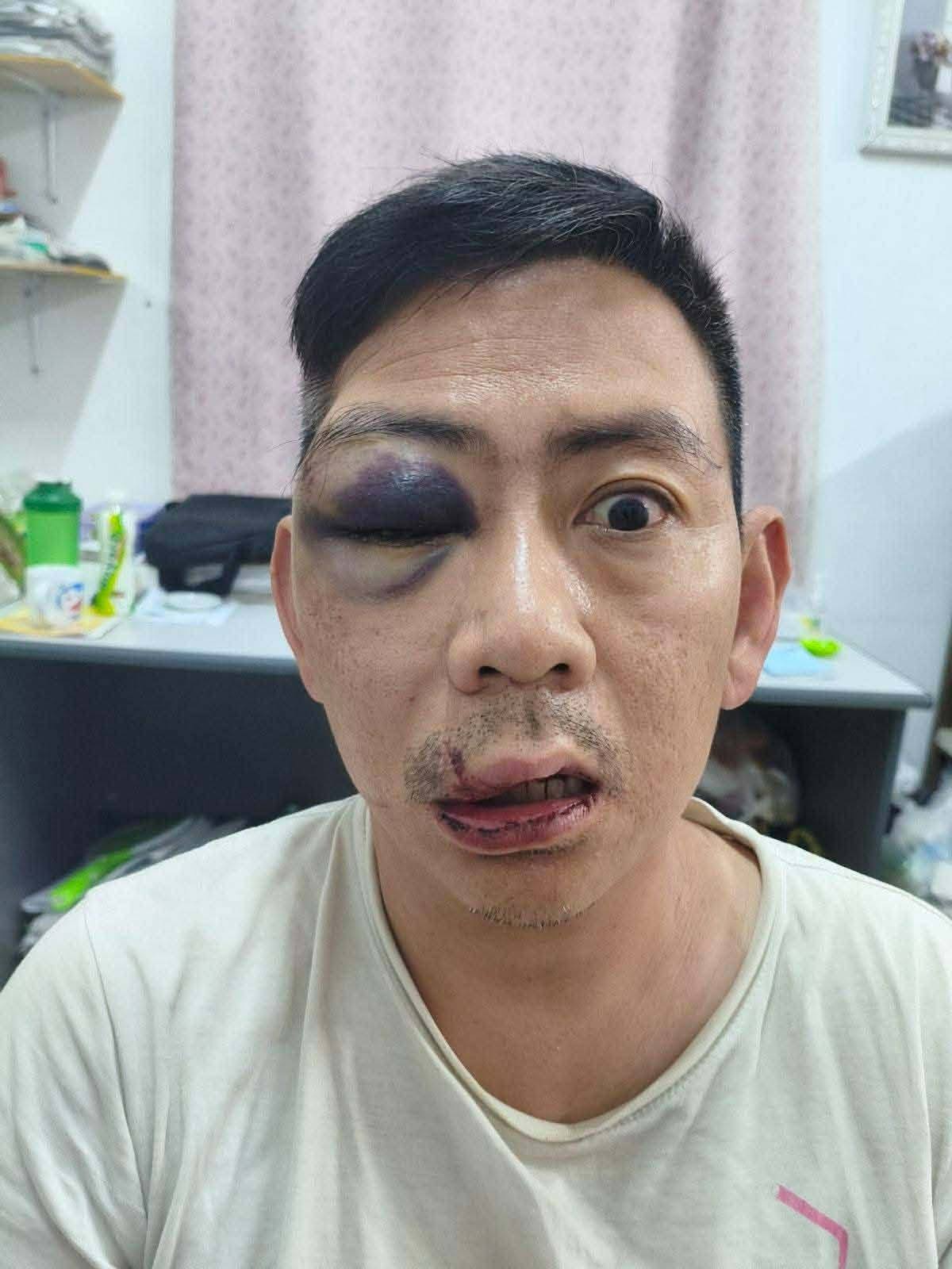 ကလောတွင် အရက်မူးနေသည့် ရာအိမ်မှူးနှင့်အ ပေါင်းအပါများကအထက်တန်းရှေ့နေတစ်ဦးကို ဝိုင်းဝန်းထိုးကြိတ်